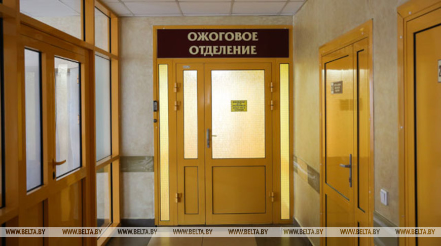 В Гродно на школьнице загорелась одежда от плиты: девочку госпитализировали в тяжелом состоянии