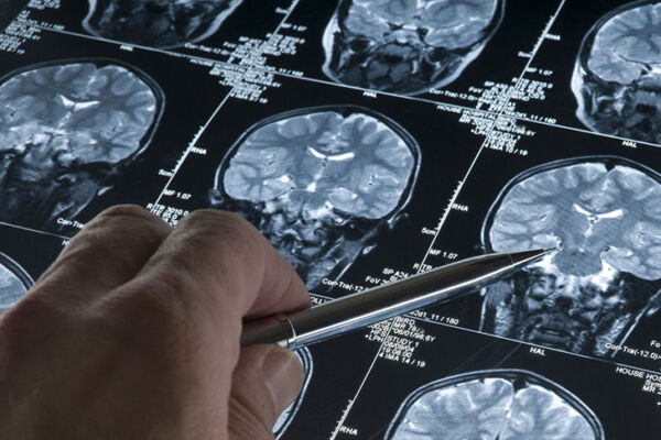 Китайские ученые выяснили, как мозг переключается между воспоминаниями и восприятием реальности